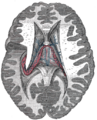 Thumbnail for version as of 17:28, 18 May 2026