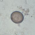 Egg of Taenia
