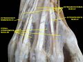 Extensor digiti minimi muscle