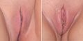 Female sexual arousal