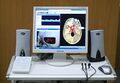 Doppler ultrasound analyzer used for measuring blood velocity