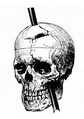 Diagram of Phineas Gage's skull from 1868