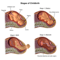 Stages of Childbirth