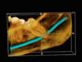 Cone beam computed tomography