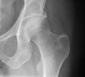 Healthy hip joint