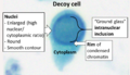 Decoy cell cytology
