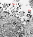 Electron micrograph of HTLV-1 and HIV-1 viruses.
