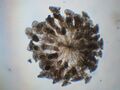 20100708 colonial rotifer Conochilius