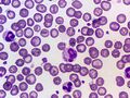 Canine Distemper Virus Cytoplasmic Inclusion Body (Blood smear, Wright's stain)