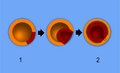 Diagram of gastrulation process