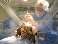 Deep Brain Stimulation (DBS) in pediatrics