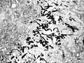 Hyphae of Pythium insidiosum