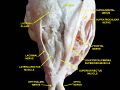 Ophthalmic nerve