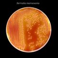 Serratia marcescens bacteria