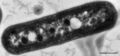 Synechococcus elongatus PCC 7942 electron micrograph showing carboxysomes