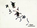 Bifidobacterium adolescentis Gram stain