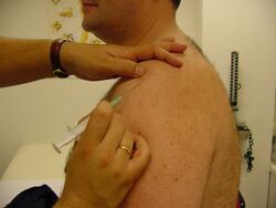 Joint injection