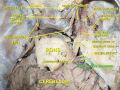 Vestibulocochlear nerve slide