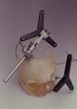 Stereolithography model of a skull
