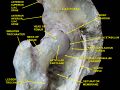 Hip joint – lateral view