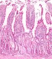 Small intestine low magnification