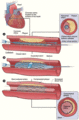 Coronary stent