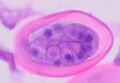 Pinworm (parasite)