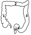 Dickdarm Schema