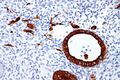 Intermediate trophoblast - LMWK - high magnification