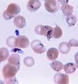 Parasite load