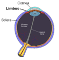 Limbus