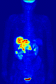 Biological aspects of fluorine