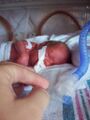 Neonatal intensive care unit
