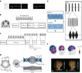Experimental setup for noninvasive theta-burst stimulation of the human striatum to enhance striatal activity and motor skill learning