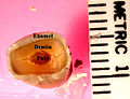 Tooth enamel