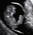 8 weeks 3 days with umbilical cord