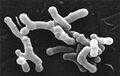 Bifidobacterium longum en microscopie électronique