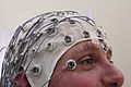 EEG recording cap used in total intravenous anaesthesia