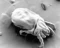 A scanning electron micrograph of a female dust mite