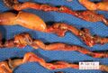 Neonatal necrotizing enterocolitis, gross pathology
