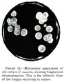 Coccidioides immitis microscopy