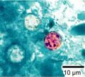 Cyclospora cayetanensis stained