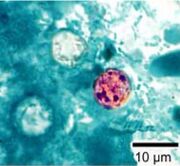 Cyclospora cayetanensis