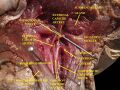Muscles, arteries and nerves of neck. Newborn dissection.