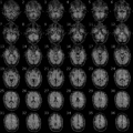 Functional magnetic resonance imaging