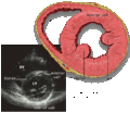Transthoracic echocardiogram
