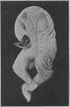 Acephalus Boulgakow