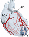 Left coronary artery