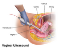 Vaginal ultrasound