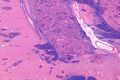 Nucleus basalis of Meynert - Very Low Magnification